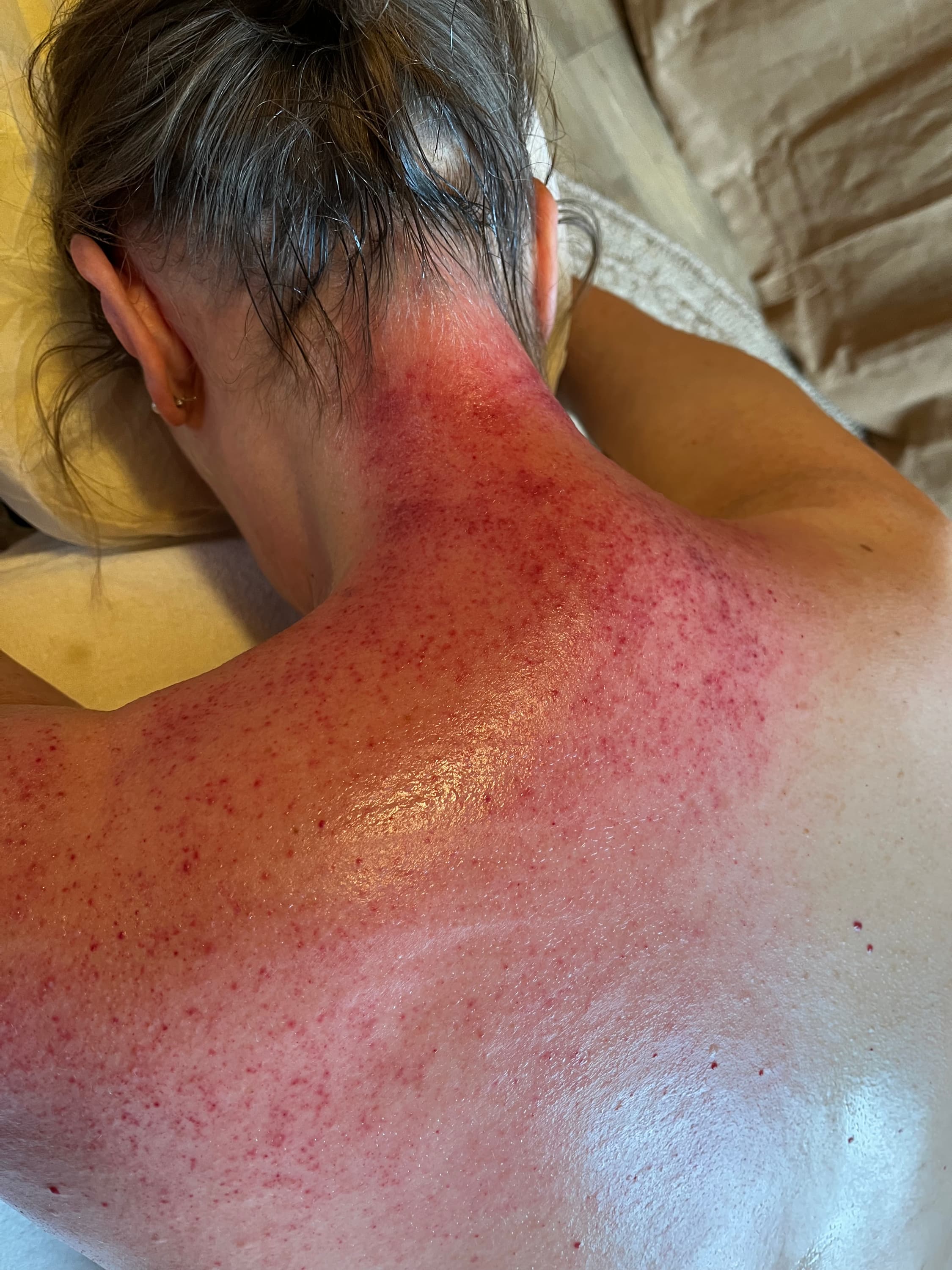 Transformational Cupping®: leren luisteren naar je lichaam